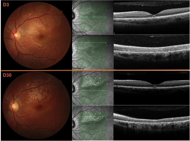 File Retina Image Bank File Retina Image Bank