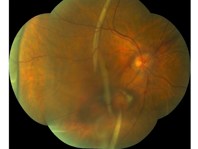 File Retina Image Bank File Retina Image Bank