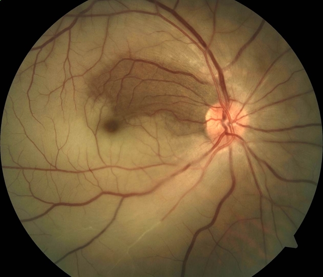 ØµÙØ±Ø© ذات ØµÙØ©