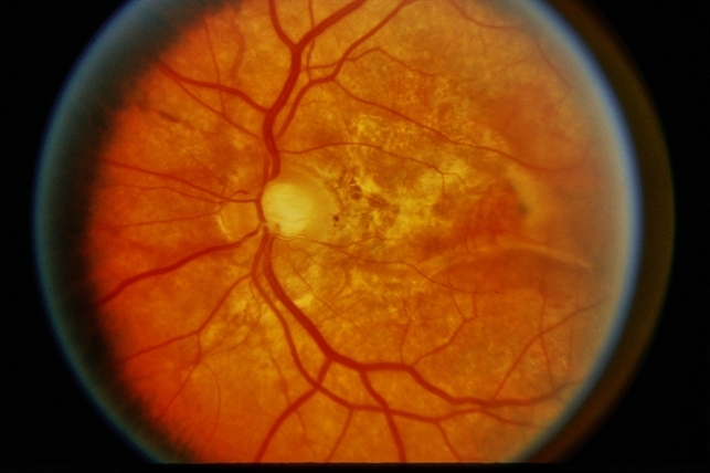 File Retina Image Bank File Retina Image Bank