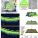 Pentosan Maculopathy OCT Right