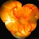 Albinotic Fundus