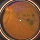 Bear Tracks - Smartphone Fundus Image