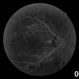 Diabetic Retinopathy Hard Exudates OD Early Phase Diabetic Retinopathy Hard Exudates OD Early Phase