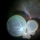 Intraocular Multiple Cysticercus Intraocular Multiple Cysticercus