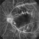 Retina