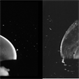 Vitreous Structure in Youth Vitreous Structure in Youth