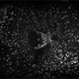 Severe Retinal Ischemia Secondary to Diabetic Retinopathy Severe Retinal Ischemia Secondary to Diabetic Retinopathy