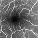 Micro Capillaries in Fluorescein Angiogram - Normal