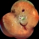 ANAEMIC RETINOPATHY