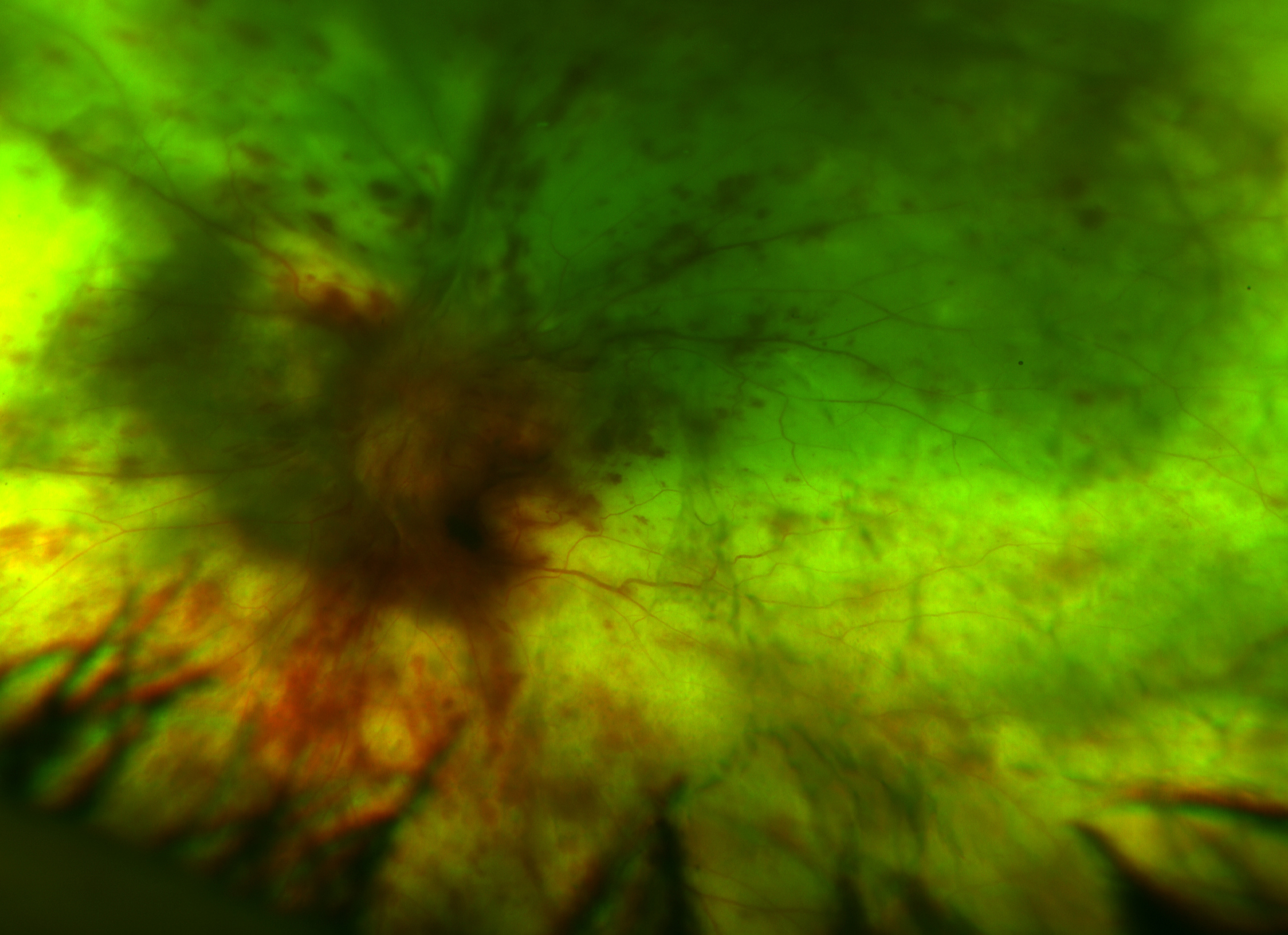 retina northwest