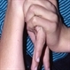 Flexibility in Marfan's Syndrome