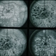 Radiation Radiation