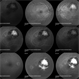 Cystercercosis