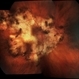 Serpigenous Choroidopathy in a 68-Year-Old Male