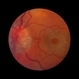 Macular Star Macular Star