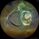 RD operated with Morning Glory Optic Disc RD operated with Morning Glory Optic Disc