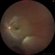 Myelinated Nerve Fibres Myelinated Nerve Fibres