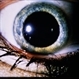 Wilson's Disease Wilson's Disease