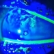 Herpetic Corneal Ulcer Herpetic Corneal Ulcer