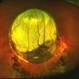 Coloboma