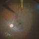 Perforating thorn injury Perforating thorn injury