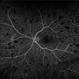 Roth Spots Roth Spots