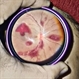Thrombocytopenia Thrombocytopenia