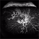 Wyburn-Mason Fluorescein Angiography