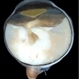Exo-Endophytic Retinoblastoma