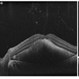 OCT Subretinal Hemorrhage OCT Subretinal Hemorrhage