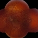 Fundus Flavimacula