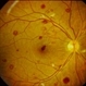 Roth spots