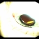 Fluocinolone Acetonide Intravitreal Implant Fluocinolone Acetonide Intravitreal Implant