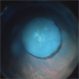 Lens Drop Lens Drop