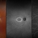 Stargardt's Disease