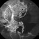 Advanced PDR Left Eye FFA Advanced PDR Left Eye FFA
