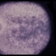 Tamoxifen Tamoxifen