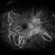 Peripheral Retinal Degeneration (L-ORD)