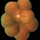 White Dot Syndrome White Dot Syndrome