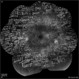 Extensive Pan-Retinal Photocoagulation