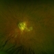 PPS Fundus OS PPS Fundus OS