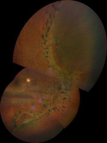 retina center near me retina center near me