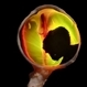 Choroidal Melanoma