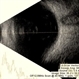 Vitreous degeneration