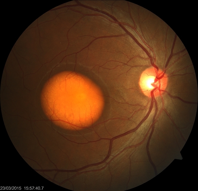 Open .md files Open .md files