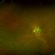 PPS-Fundus-OD0 PPS-Fundus-OD0