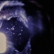 Posterior Capsule Opacification Posterior Capsule Opacification