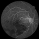 Early Venous Phase