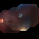 Cavernous Hemangioma Color Cavernous Hemangioma Color